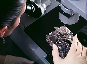Observao de clulas-tronco atravs de microscpio; agncia dos EUA aprovou testes de tratamento em humanos
