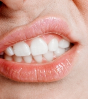 Cncer de boca afeta 30 mil pessoas por ano nos EUA