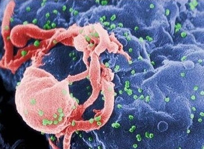 Em artigo na Nature, pesquisadores descrevem gene que estimula a produo de linfcitos T e torna algumas pessoas imunes