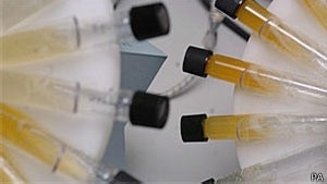 Cientistas criam teste que detecta cncer de bexiga em 