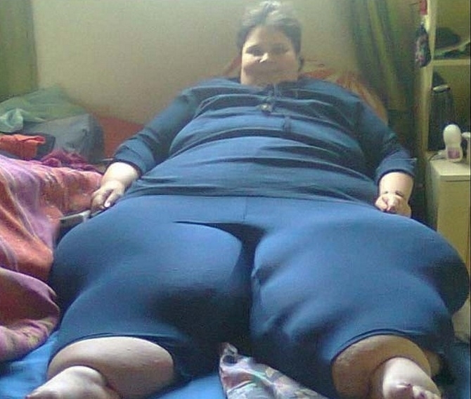 Sophia Loots chegou a ter mais de 60 kg em cada perna