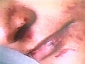 Fotos mostram hematomas no rosto de jovem