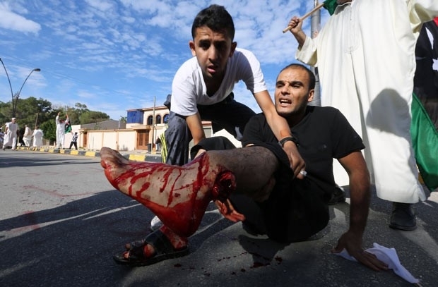 Manifestante ferido durante confrontos nesta sexta-feira (15) em Trpoli, capital da Lbia
