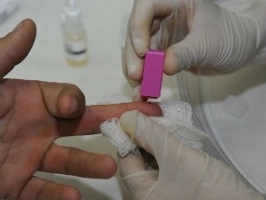 Teste de doenas infecciosas como a Aids  feito pela anlise do sangue