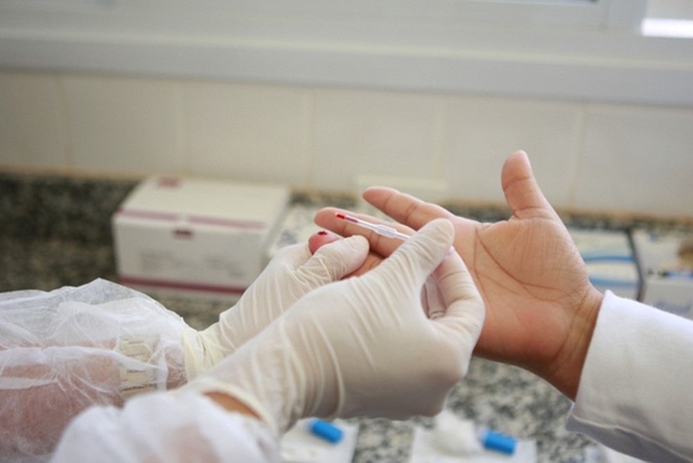 Teste HIV  oferecido gratuitamente  Foto: Divulgao