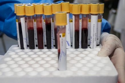 Tubos com amostras de sangue para o exame da Covid-19