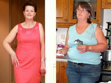 Sharon Phillips antes (dir.) e depois (esq.) da dieta que, segundo ela, permitiu descobrir trs tumores fatais