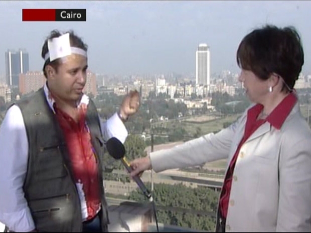 Reprter da BBC El Sawey, com a camisa manchada de sangue e atadura na cabea
