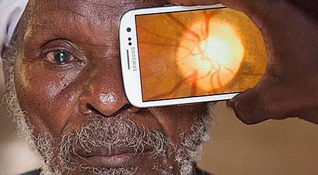 Aplicativo de celular pode fazer exames de fundo de olho em pacientes