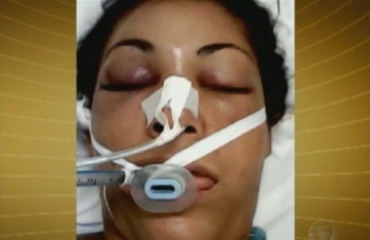 Vanessa est em coma e sofreu leses no rosto e na cabea
