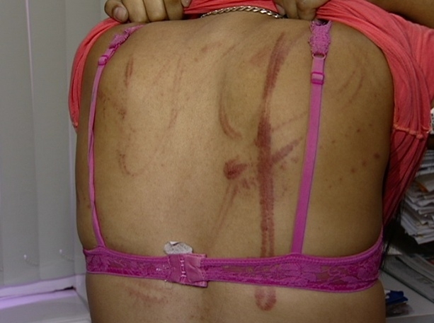 Adolescente foi agredita pelo namorado, segundo a polcia, em Vitria