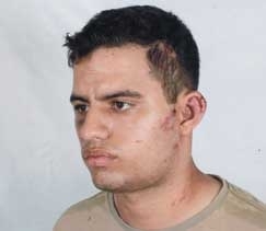 Aluno do 3 ano do Ensino Mdio, Marcos Vincius Souza Silva teve vrios ferimentos no rosto