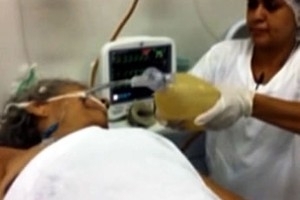 Enfermeira faz ventilao manual em idosa  por falta de aparelho no PS de Cuiab