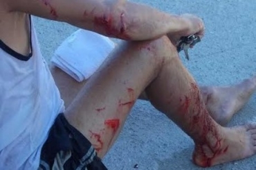 Ciclista passava pelo local e foi ferido pelas garrafas quebradas