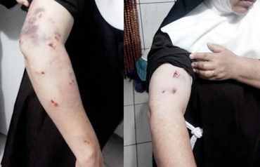 Freiras tiveram ferimentos depois de serem atacadas por co de guarda, em Juna (MT).