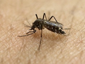 Vrus da zika pode provocar microcefalia em bebs. (Foto: AP Photo/Andre Penner, File)
