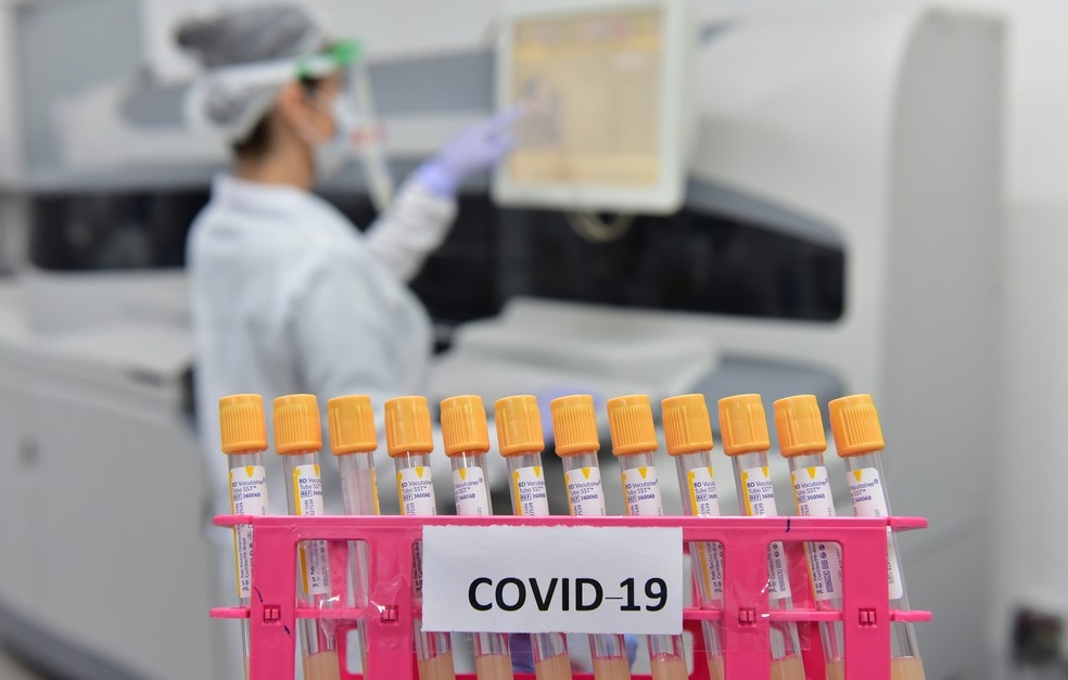 Equipamento automatizado para pesquisa de anticorpos contra o vrus SARS-CoV-2 (Covid-19) e outras anlises  Foto: Ector Gervasoni