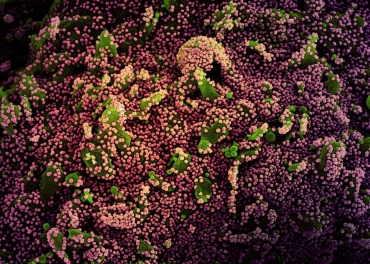 Clula (verde) fortemente infectada com partculas do vrus da covid-19 (roxo)