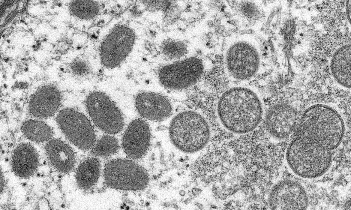 Vírus Monkeypox visto usando microscopia
