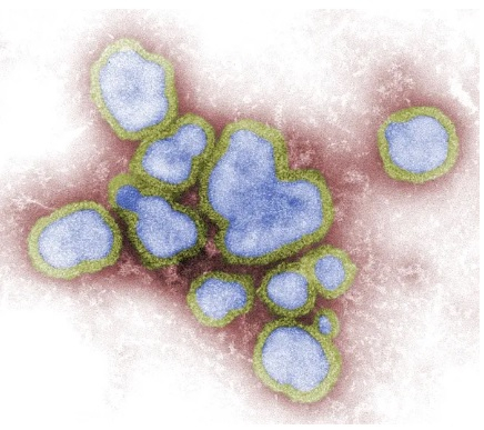 Imagem de microscopia mostra vrios vrus de influenza A, causador da gripe.  Foto: CDC/ F. A. Murphy