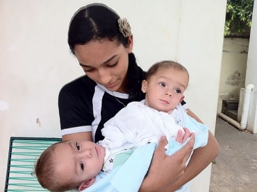 Siameses tm sete meses de vida e devem ser separados aps exames