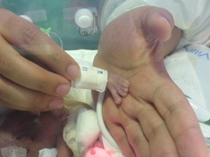 Carolina Terzis nasceu com 27 centmetros, na 25 semana de gestao.