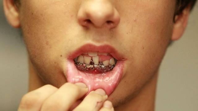 O menor perdeu dois dentes durante a agresso