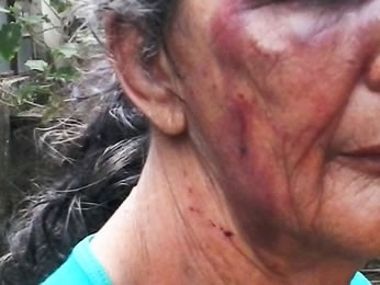 Mulher foi encontrada em residncia com vrias leses (Foto: site AGORA MT)
