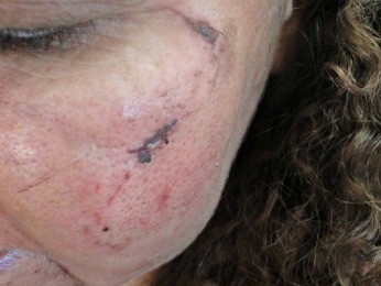 Mulher estava com ferimentos e teve parte da orelha arrancada (Foto: Simone Teles Francisco da Silva/ CR2-PM/MT)