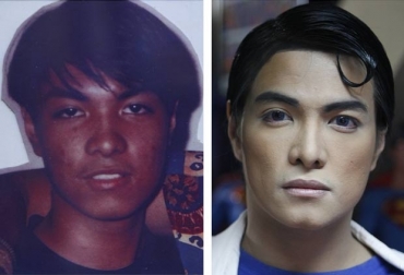 Filipino Herbert Chavez, de 35 anos, realizou vrias cirurgias plsticas desde 1995