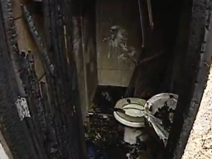 Menino se escondeu no banheiro durante o incndio e teve 60% do corpo queimado