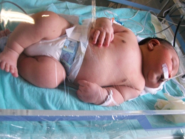 Beb Gustavo nasceu com 6,7 quilos em hospital de Salvador