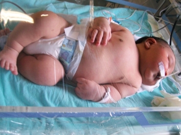 Beb Gustavo nasceu com 6,7 quilos em hospital de Salvador
